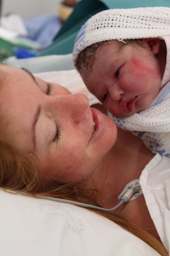 Amy Dawes suffered pelvic organ prolapse after her forceps delivery.