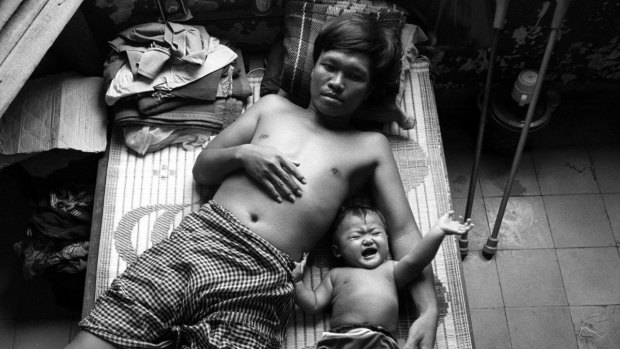Nhek Sarun, 34, lies with his eight-month-old baby Nheck Chantrea in the Phnom Penh Military Hospital after stepping on a land mine near Pailin. 