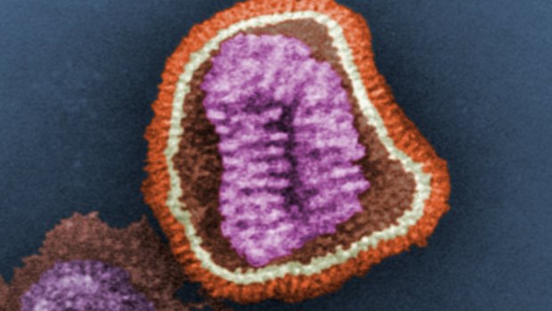 A negative-stained transmission electron microscopic image shows the ultrastructural details of an influenza virus particle.