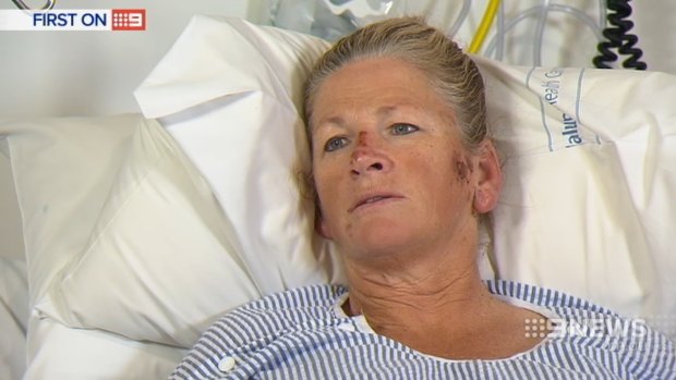Kym Carr says she doesn't remember being hit, but woke up in the ambulance. 