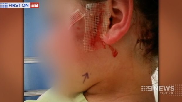 The girl was rushed to Princess Margaret Hospital where she had surgery to repair extensive damage from the dog attacks.
