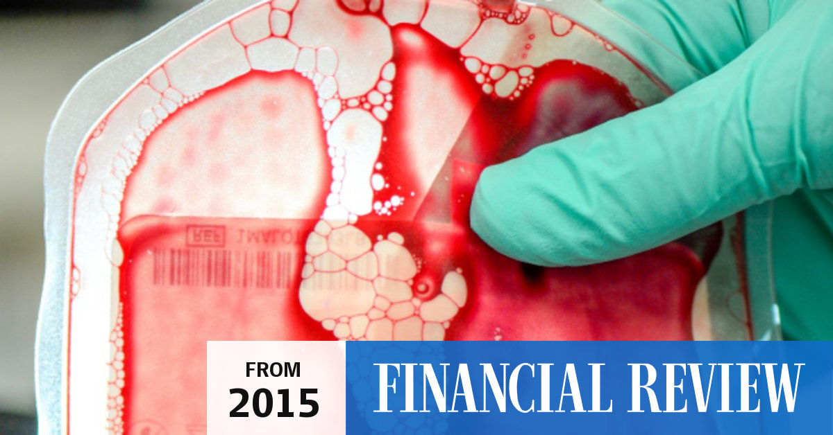 Counting White Blood Cells May Help Predict The Progression Of Prostate Cancer