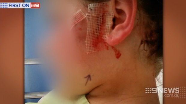 The girl was rushed to Princess Margaret Hospital where she had surgery to repair extensive damage from the dog attacks.