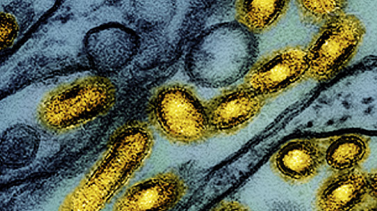 Colorised image showing avian influenza A H5N1 virus particles (yellow), grown in Madin-Darby Canine Kidney (MDCK) epithelial cells (blue).