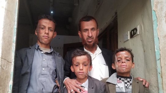 From left, Omar, 12, with his father Mohammed and brothers Ahmed, 10, and Abdul, 9,bear the scars of war. 