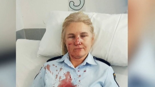 A central coast sergeant bringing a prisoner a cup of tea was allegedly kneed in the face.