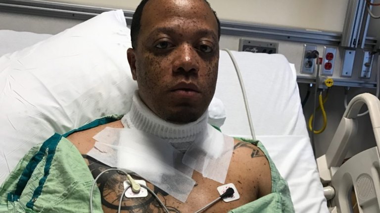 Man nearly electrocuted after falling asleep with his iPhone charging in bed