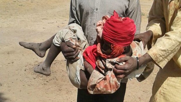A man carries an injured child following a military air strike at a camp for displaced people in Rann, Nigeria.