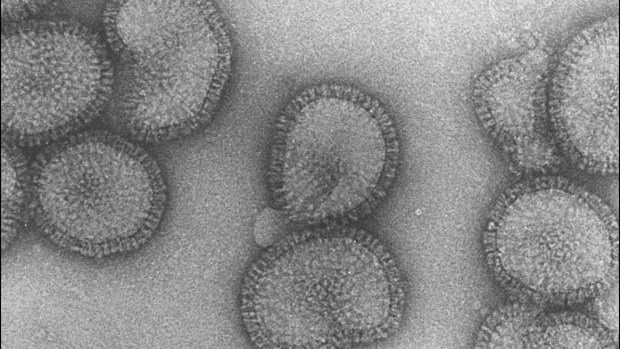 An electron microscopy image of the flu virus