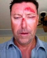 Robert Allenby, after he claims he was abducted, assaulted and robbed. 