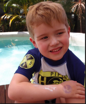 Four year old Finn Heritage wears a purple skin patch on his wrist warning him he needs more sunscreen.