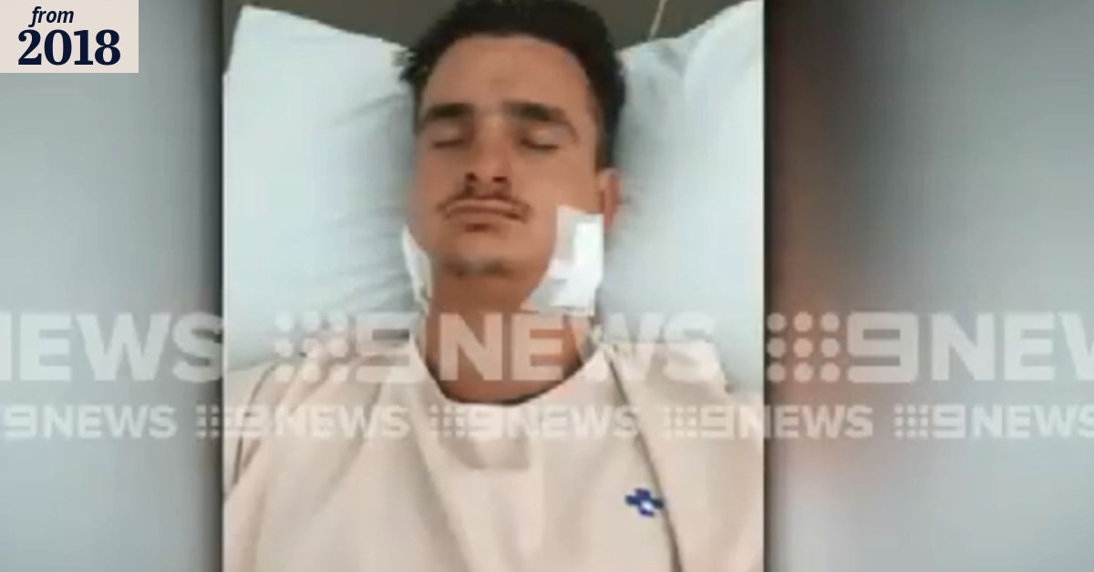 Perth man the victim of one punch attack in Bali