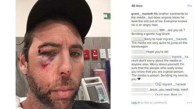 Grant Hackett has posted an image of himself to social media, his face bloody and bruised.