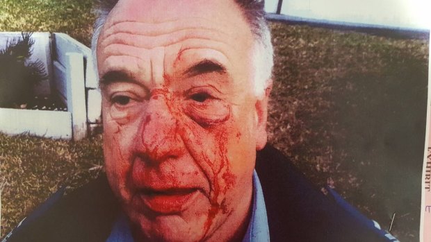 One of the graphic police images depicting then senior constable Daniel Poole's injuries.