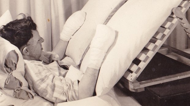 Ken Gilkes in hospital in East Grinstead during World War II.