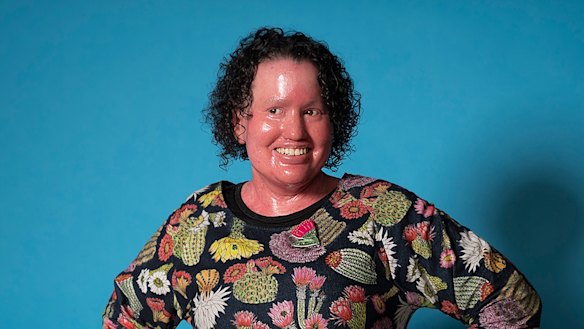 Disability advocate Carly Findlay said McGuire's comments were damaging towards the disabled community. 