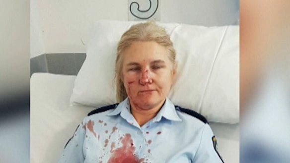 A Central Coast sergeant bringing a prisoner a cup of tea was allegedly kneed in the face.