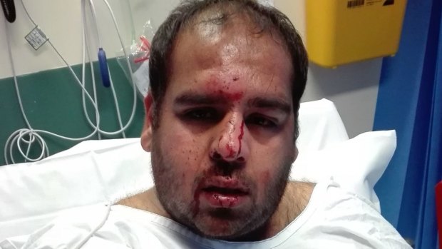 Mr Sachdeva said his confidence was shaken after allegedly being struck in the head and racially abused.