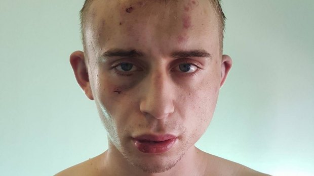Dylan Souster, 22, suffered cuts, bruising and swelling to his face and body.
