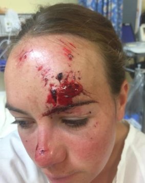 Miraculously, Megan Taylor escaped with just one bruise and a cut, that required four stitches.