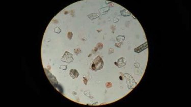A microscope image of some of the plastic found inside fish Angelina dissected. 