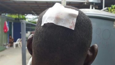 A photograph showing an injury allegedly sustained in the Good Friday incident at Manus Island regional processing centre.
