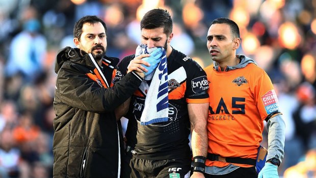 Season over: James Tedesco.