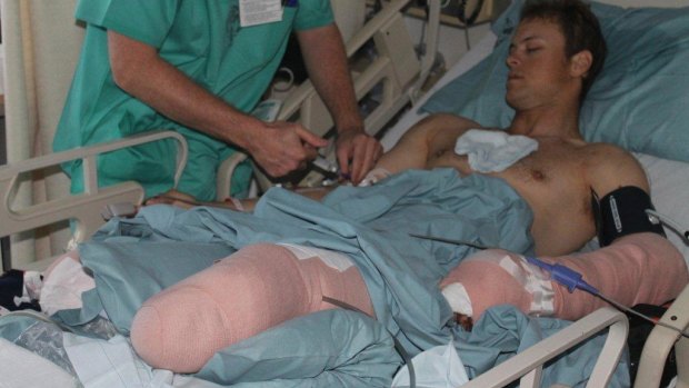 Curtis McGrath recovering in hospital after losing his lower legs in an explosion in Afghanistan.