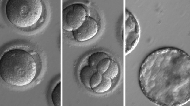 This sequence of images shows the development of embryos after the co-injection of a gene-correcting enzyme and sperm from a donor.