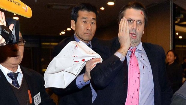 Mark Lippert was led away immediately following the attack.
