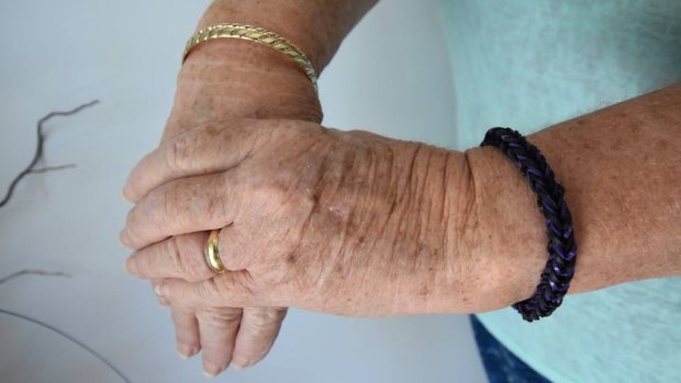 The only jewellery the 68-year-old Dawesville woman was left with was two bangles, her wedding ring and a pair of earnings.