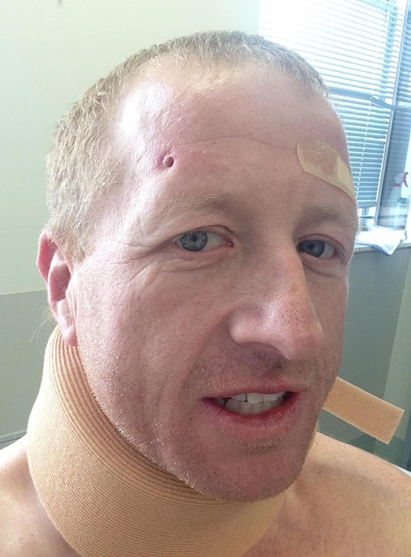 Dean Smith says the pain was intense after he broke his back. 