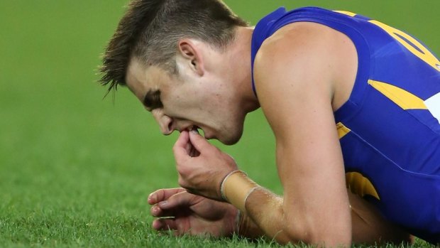 West Coast's Elliot Yeo lost part of two front teeth in 2014. He has since re-injured his hand.