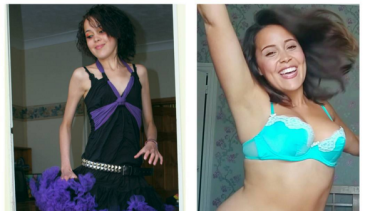 Megan Jayne's before-and-after pictures have been viewed by thousands.