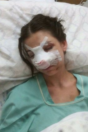 Shani suffered severe injuries to her face during the crash.