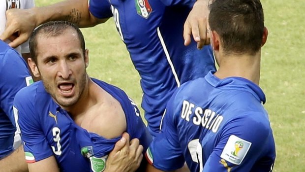 Italy's Giorgio Chiellini displays his shoulder, showing apparent teeth marks.