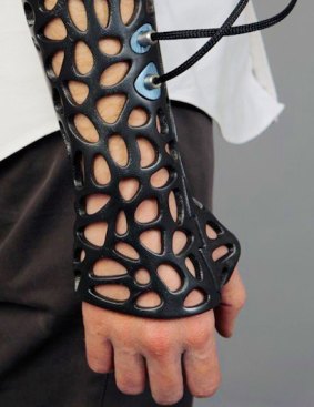 Osteoid: The 3D-printed cast could help heal bones faster.