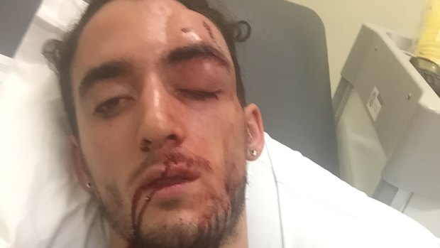 Isaac Keatinge - man bashed in Newtown.