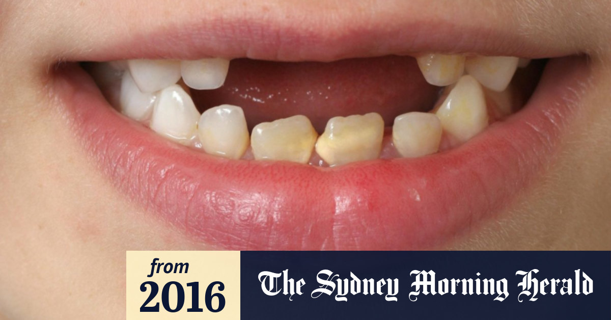Surprisingly little evidence for the usual wisdom about teeth
