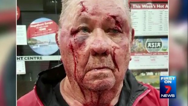 Ernie Haynes, 76, was attacked as he went to get his morning newspaper.