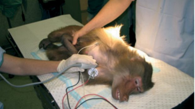 A baboon being experimented on at Royal Prince Alfred Hospital in Sydney. 