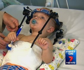 Jaxon Taylor was treated in the Lady Cilento Children's hospital.