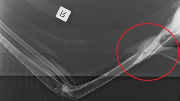 An X-ray of the pelican's broken wing.