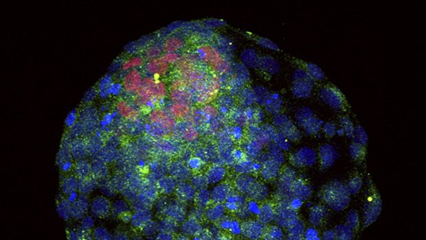 A human embryo with DNA stained blue. A new study suggests that endogenous retroviruses may assist in human development by defending young cells from infections by other viruses.