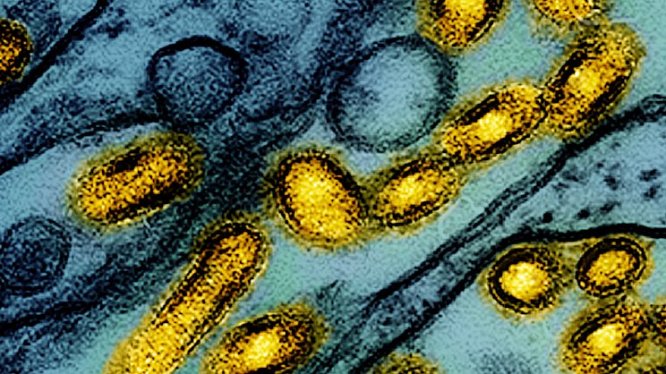 smh.com.au - Gus Goswell - 'It scares me more than anything else': Inside the next global health crisis