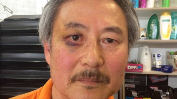 Former Korean Army lieutenant, high school teacher and counsellor Paul Shin shows off a black eye after a vicious attack by a 17-year-old in his general store.