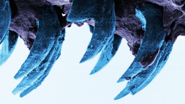 A scanning electron microscope image of limpet teeth.
