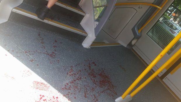 Blood spattered through several carriages.