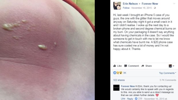 A Forever New customer was burnt from a glittery phone case she bought in 2015.