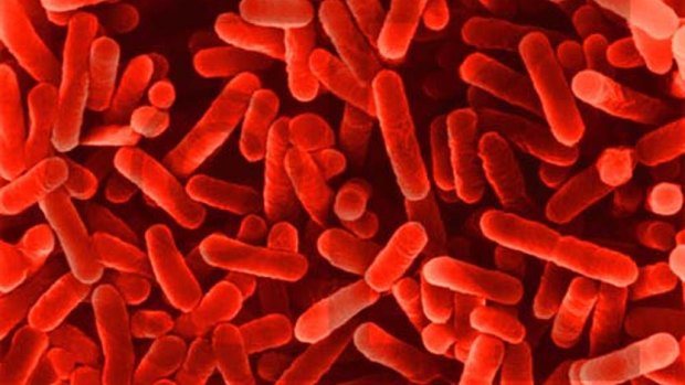 A patient at the Mater Private Hospital has tested positive to the deadly Legionella bacteria.